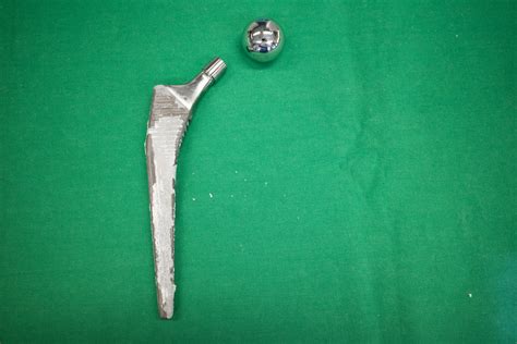 Photo of Grandma's Titanium Hip Joint Left Behind After Cremation Goes