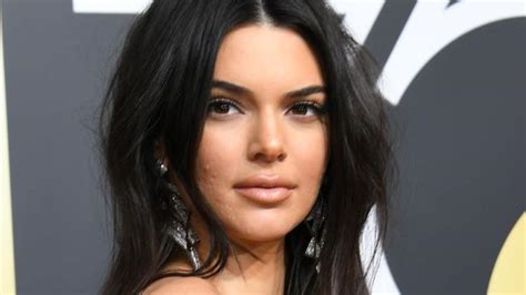 Kendall Jenner Opens Up About Her Golden Globes Acne ‘never Let That S