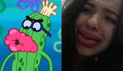 Kylie Jenners Lip Challenge Is Giving Girls “fish Lips