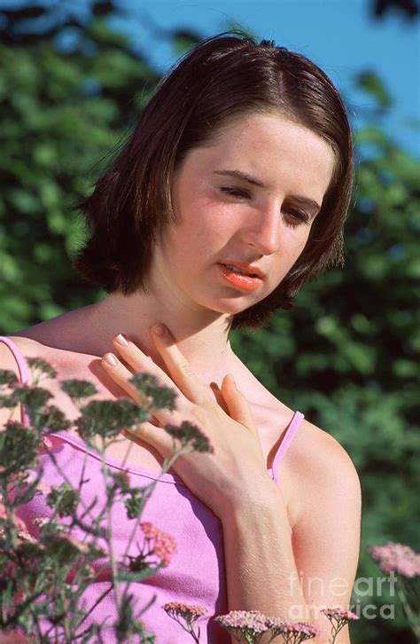 Hay Fever Photograph By Lea Paterson Science Photo Library Fine Art America