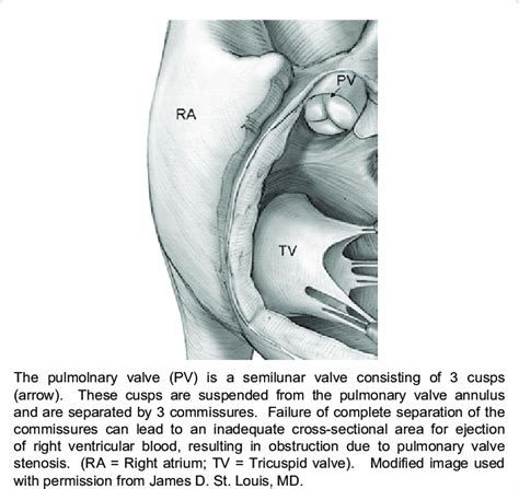 Pulmonary Valve Anatomy Download Scientific Diagram