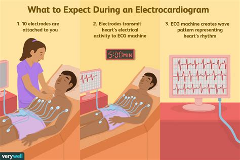 ¿qué Es Un Electrocardiograma Ecg O Ekg Medicina Básica