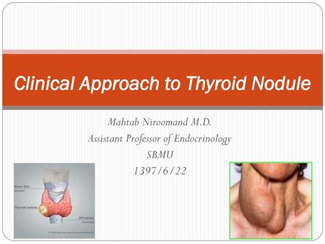 Ppt Clinical Approach To Thyroid Nodule Powerpoint Presentation Free