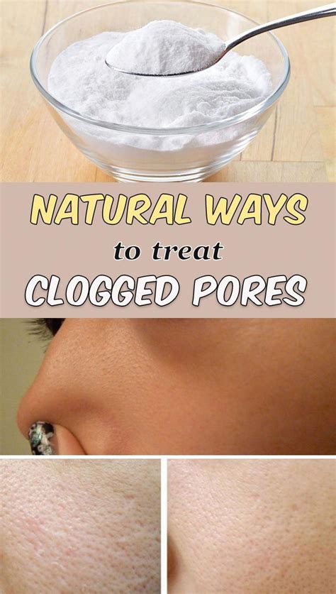 Here Are 5 Natural Ways To Treat Clogged Pores Theyre Easy To Do At