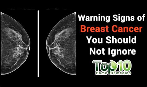 We did not find results for: Do You Know the Warning Signs of Breast Cancer? | Top 10 ...