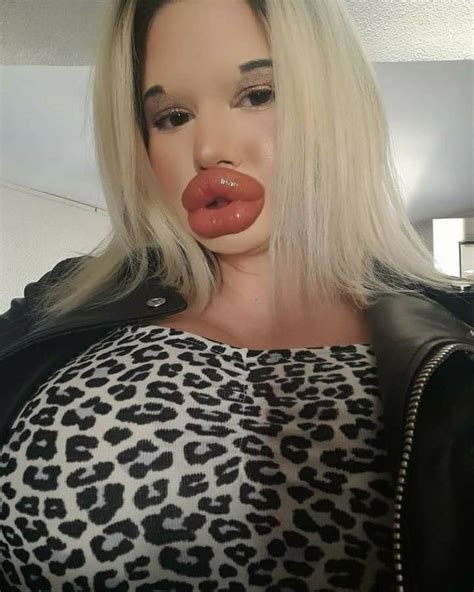 Real Life Barbie With Worlds Biggest Lips Plans To Make Them Even