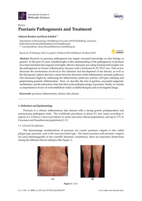 Pdf Psoriasis Pathogenesis And Treatment