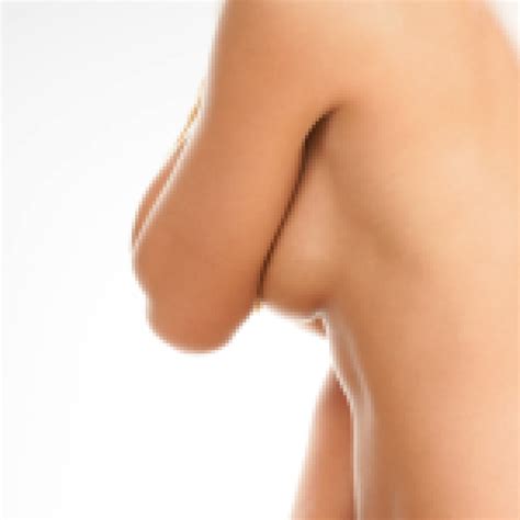 Large Breasts Can Cause Back Pain And Breast Pain Breast Reduction