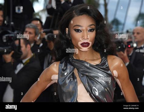 Model Winnie Harlow Poses For Photographers Upon Arrival At The