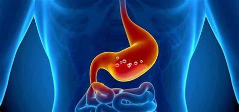 Повышенная кислотность желудка: 5 главных симптомов Картинка - Повышенная кислотность желудка: 5 главных симптомов