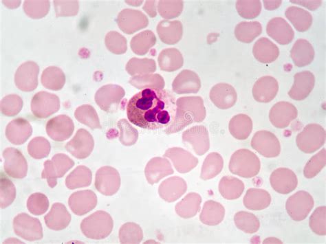 Neutrophil Cells Stock Image Image Of Basophil Monocyte 92594009