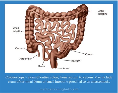 Screening Colonoscopy With Polyp Removal Coding Medical Coding Buff