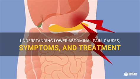 Understanding Lower Abdominal Pain Causes Symptoms And Treatment Medshun