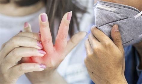 It was first identified in december 2019 in wuhan,. Covid new strain symptoms: Four unusual symptoms reported ...