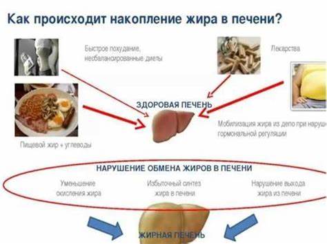 Диета при гепатозе печени жировой Жировой гепатоз печени. диета при жировом гепатозе: примерное меню Жировой гепатоз печени. диета при жировом гепатозе: примерное меню Диета при гепатозе печени жировой