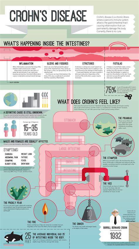 An Infographic About Crohns Disease And Its Effects On The Body