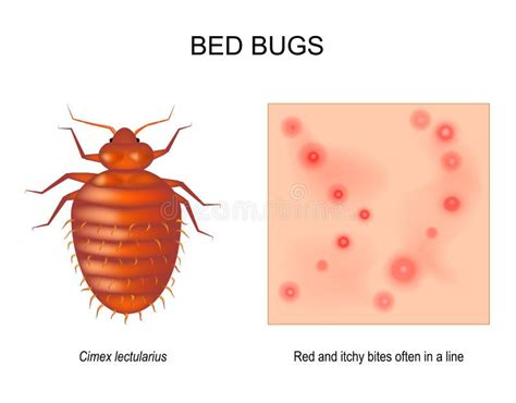 Bug Bite Bumps What Do Bed Bug Bites Look Like