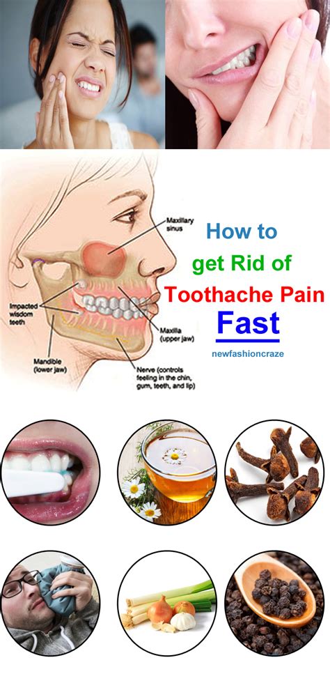 Tooth fractures and chips can also occur. Pin on Beauty & Health