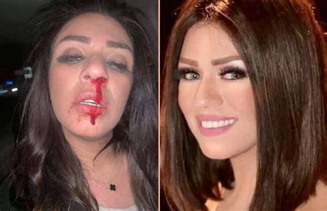 موجات من الهجوم طالت زوج الفنانة شاهيناز ضياء الدين، بعد نشر صورة لها بأنف نازف، متهمة زوجها بالتعدي بالضرب عليها هي. الفنانة شاهيناز ضياء بعد اعتداء زوجها عليها: كاميرات ...