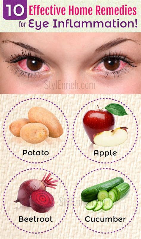 Home Remedies For Eye Inflammation 10 Effective Ways