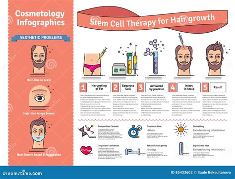 Vector Illustrated Set With Stem Cell Therapy For Hair Growth Stock