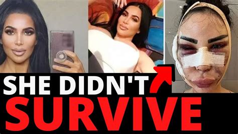kim kardashian look alike passes away following cosmetic procedure the coffee pod youtube