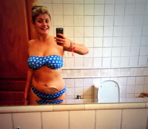 Beach Body Ready Woman With Colostomy Bag Hits Back At Protein World Ad Daily Star