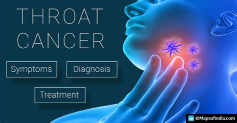 10 symptoms of throat cancer you mustn t ignore india