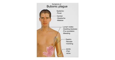 Main Symptoms Of Black Death Bubonic Plague Chart Poster