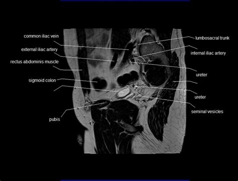 This mri male pelvis axial cross sectional anatomy tool is absolutely free to use. Search Results for "Calendario 2015 Con Las Lunas ...
