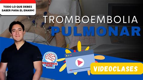 Tromboembolia pulmonar ENARM Dr Damian Treviño YouTube