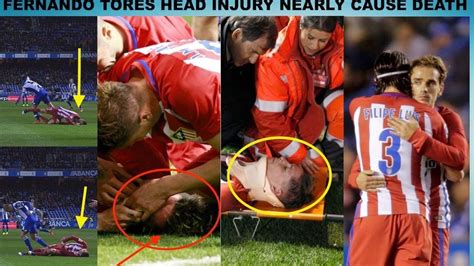 Fernando Torres Horrible Head Injury Deportivo La Coruna Vs Atletico