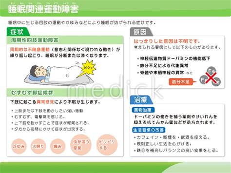 睡眠関連運動障害 - 医療のイラスト・写真・動画、素材販売 ...