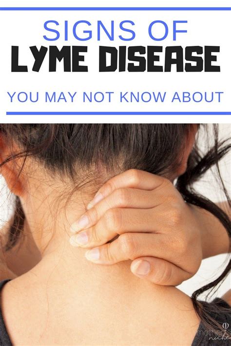 Signs Of Lyme Disease My Experience With Lyme Disease Lyme Disease