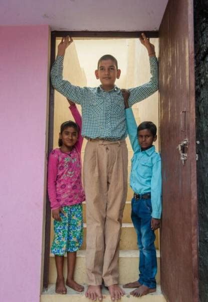This Indian Boy Is The Tallest In The World 13 Pics