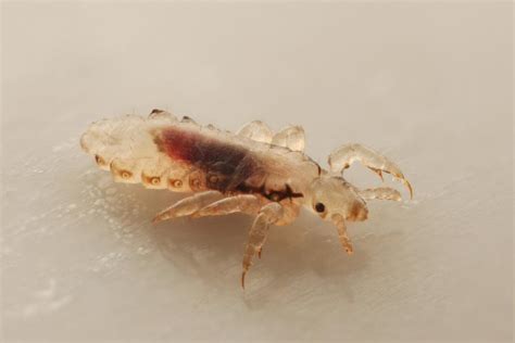 Can Head Lice Survive On Carpet