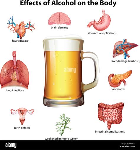 Effects Of Alcohol On The Body Illustration Stock Vector Image And Art