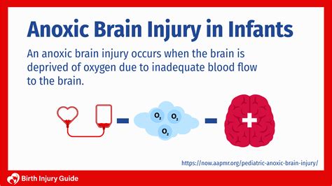 Infant Brain Damage Explained Birth Injury Guide