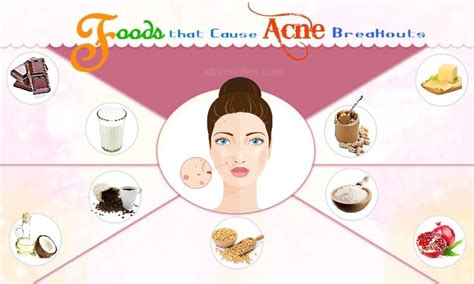 55 Foods That Cause Acne Breakouts In Adults