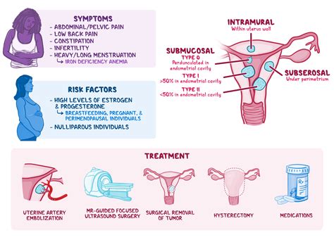 Osmosis Leiomyoma Of Uterus Uterine Fibroid What Is It Causes Types Diagnosis Treatment