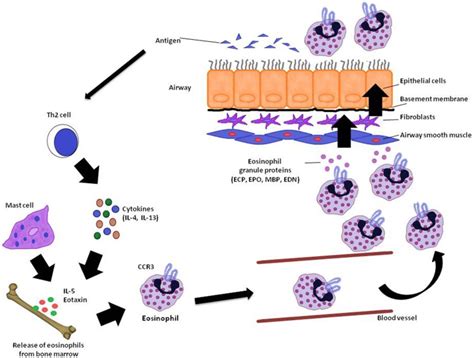 Eosinophil Recruitment In Asthma In The Reaction Of The Airway To