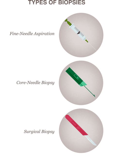Breast Biopsy Procedure Types What To Expect And Results Guide