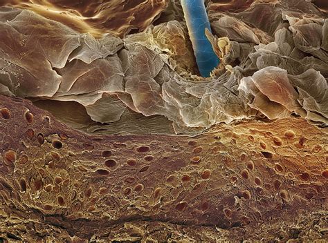 Skin Section Sem Photograph By Steve Gschmeissner Pixels