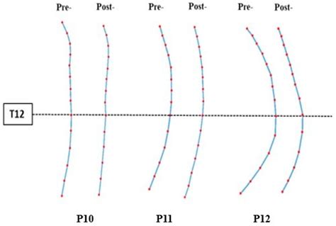 Jcm Free Full Text Sagittal Spinal Alignment In People With Chronic