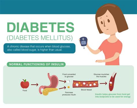 Diabetes Mellitus Types Risk Causes And Its Treatment