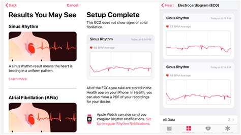 Apple Watch Ecg App What Is It How Does It Work And Is It Accurate
