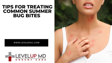 Summer Bug Bites Treatment Tips And When To Seek Medical Care