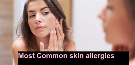 Common Types Of Skin Allergies Healthy Life