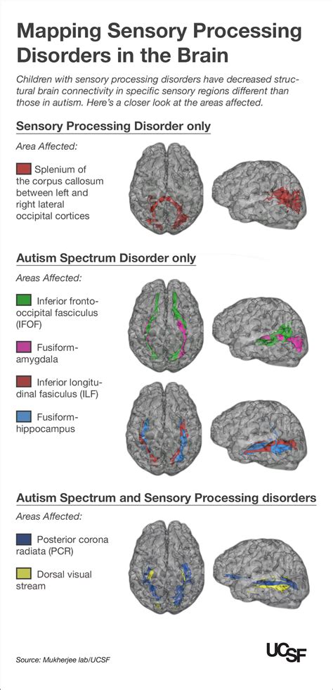 Kids with Autism, Sensory Processing Disorders Show Brain Wiring