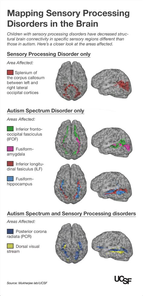 Autism Brain Comparison